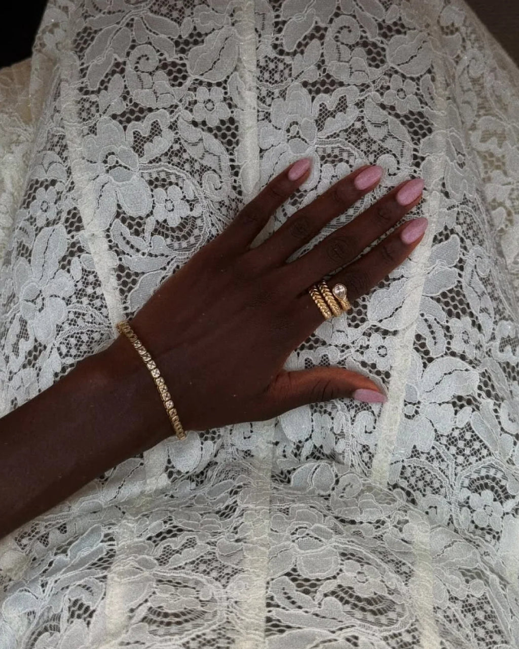 Kinsley White Lace Midi Dress, white dress white, ​white graduation dress​